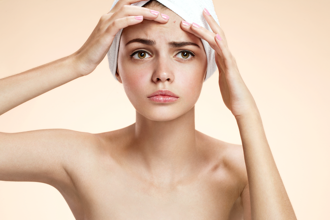 donna usa i prodotti contro l'acne di the ordinary per migliorare i brufoli